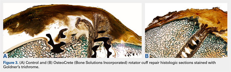 (A) Control and (B) OsteoCrete (Bone Solutions Incorporated) rotator cuff repair histologic sections stained with Goldner's trichrome.