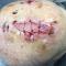 . Pulley guiding sutures (3-0 polyglactin 910) decrease the size of the defect and secure a cadaveric split-thickness skin graft over the remaining exposed periosteum. . Pulley guiding sutures (3-0 polyglactin 910) decrease the size of the defect and secure a cadaveric split-thickness skin graft over the remaining exposed periosteum.