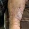 Leg nodules Leg nodules