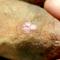 Wart Wart