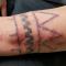 Wrist tattoo with rash Wrist tattoo with rash