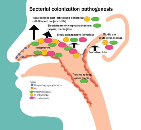 Profile Of Respiratory Bacteria In Children Younger Than 6 Months 