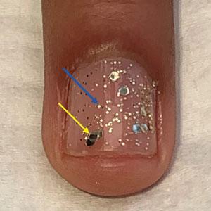 Gold glitter nail polish with large (yellow arrow) and small (blue arrow) glitter particles