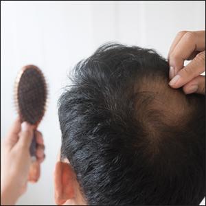 Alopecia