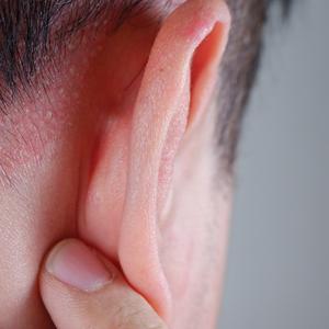 Basal cell carcinoma of the ear