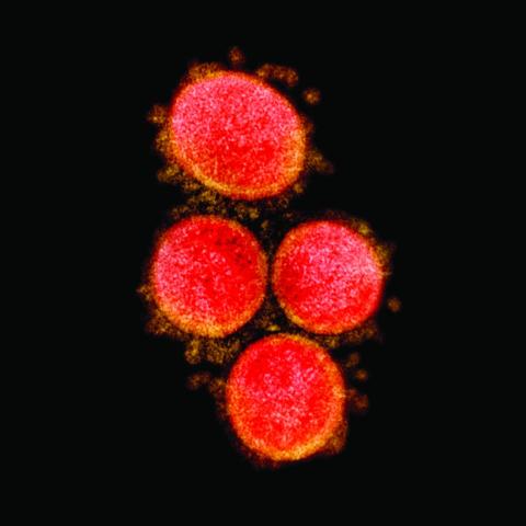 Coronavirus NIAID