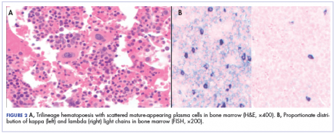 Figure 2 Trilineage hematopoesis with scattered mature-appearing plasma cells in bone marrow and proportionate distribution of kappa and lambda light chains in bone marrow.