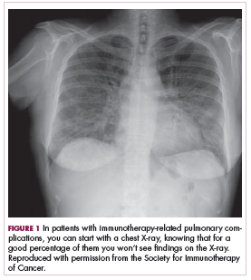 Figure 1 A chest X-ray