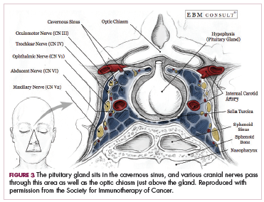 Figure 3 The pituitary gland