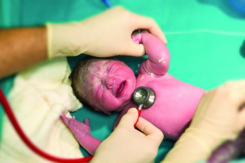 Brand New Baby. Newborn baby girl getting checked by the doctor