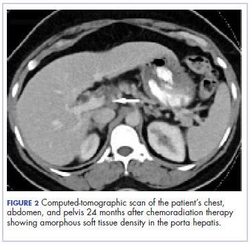 Figure 2 Pintova