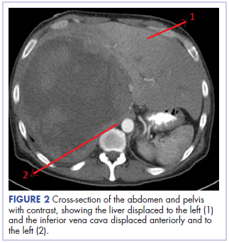 Figure 2 Yellala