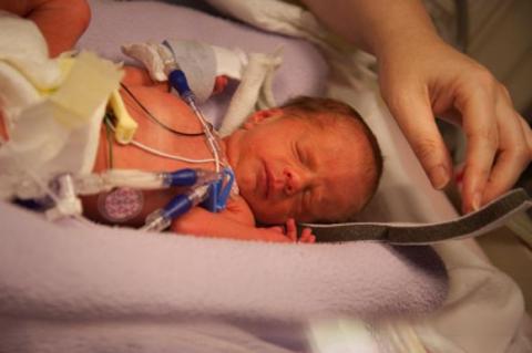 Preterm baby is shown in incubator.