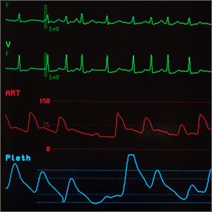 Do A-fib patients continue to benefit from vitamin K antagonists with advancing age?