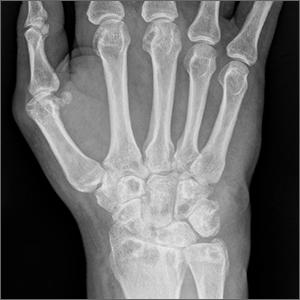 xray scan of part of the hands, wrist, and fingers