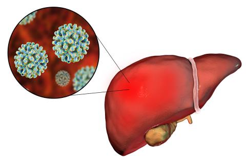 Hepatitis B