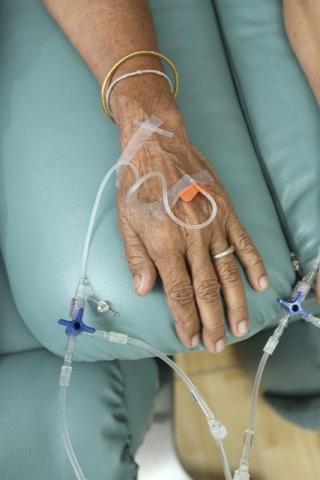 chemotherapy hand