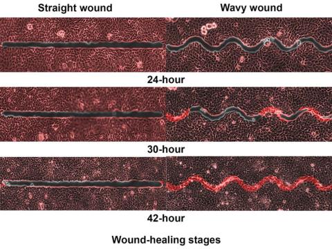 Time-lapse images show different stages of wound healing.