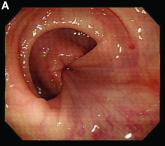 What is your diagnosis? - February 2019