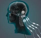 Can intraputamenal infusions of GDNF treat Parkinson’s disease?