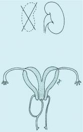 Vaginal anomalies and their surgical correction