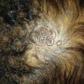 An otherwise healthy 13-month-old boy presents with a well-circumscribed, 3×4-cm, yellow-orange plaque with a verrucous velvety surface on the right side of his posterior scalp.