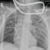 Cross at the Green, Not in Between