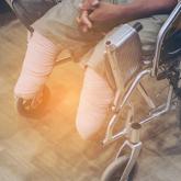 The Dermatologist’s Role in Amputee Skin Care