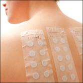 Patch Test–Directed Dietary Avoidance in the Management of Irritable Bowel Syndrome