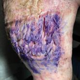 Multiple fingerlike projections on the leg