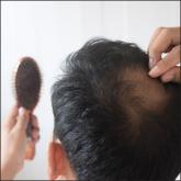 Alopecia Alopecia