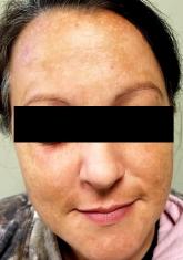 The Mother of All Skin Problems The Mother of All Skin Problems