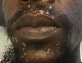 Make the diagnosis - January 2018