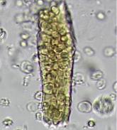 Quality in urine microscopy: The eyes of the beholder