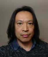 MS may be a transmissible protein misfolding disorder, study suggests