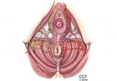 Primary care management of chronic pelvic pain in women