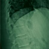 The Deer Stand Strikes Back