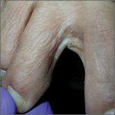 Persistent rash on feet