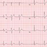 When “Different” Is Not OK