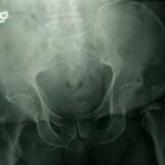 His Old Pain Is Back