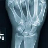 From Local Bar to Police Car