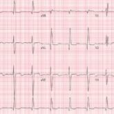 This Evaluation Is a Heart-stopper