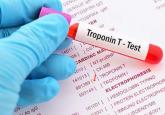Are serum troponin levels elevated in conditions other than acute coronary syndrome?