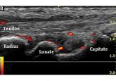 Musculoskeletal ultrasonography has arrived