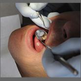 What is the optimal frequency for dental checkups for children and adults?
