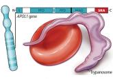 Chronic kidney disease in African Americans: Puzzle pieces are falling into place