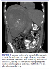Primary renal synovial sarcoma – a diagnostic dilemma