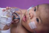Age, insurance type tied to delay in pediatric febrile UTI treatment