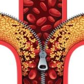 How Do I Use the New Cholesterol Guidelines?