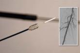 Paclitaxel-eluting stent approved for PAD